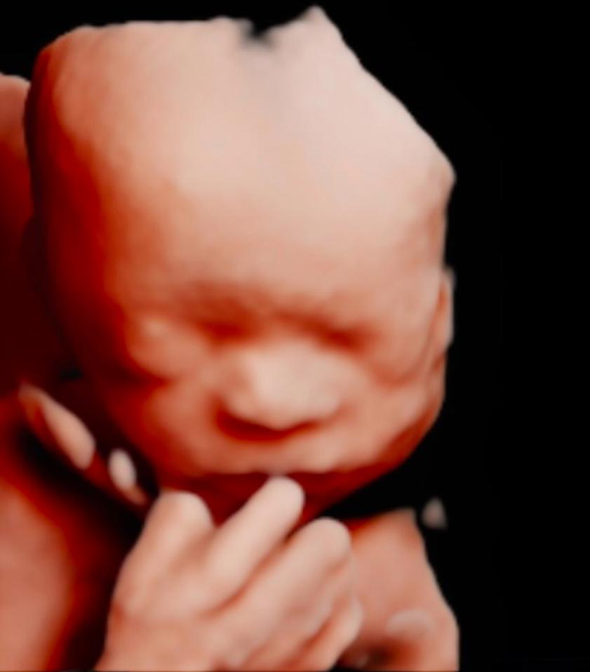 unnamed image