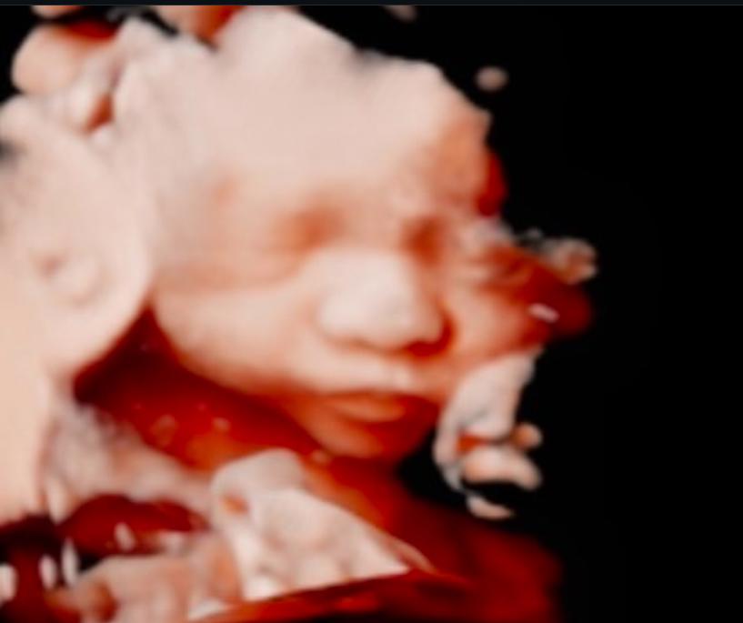 unnamed image