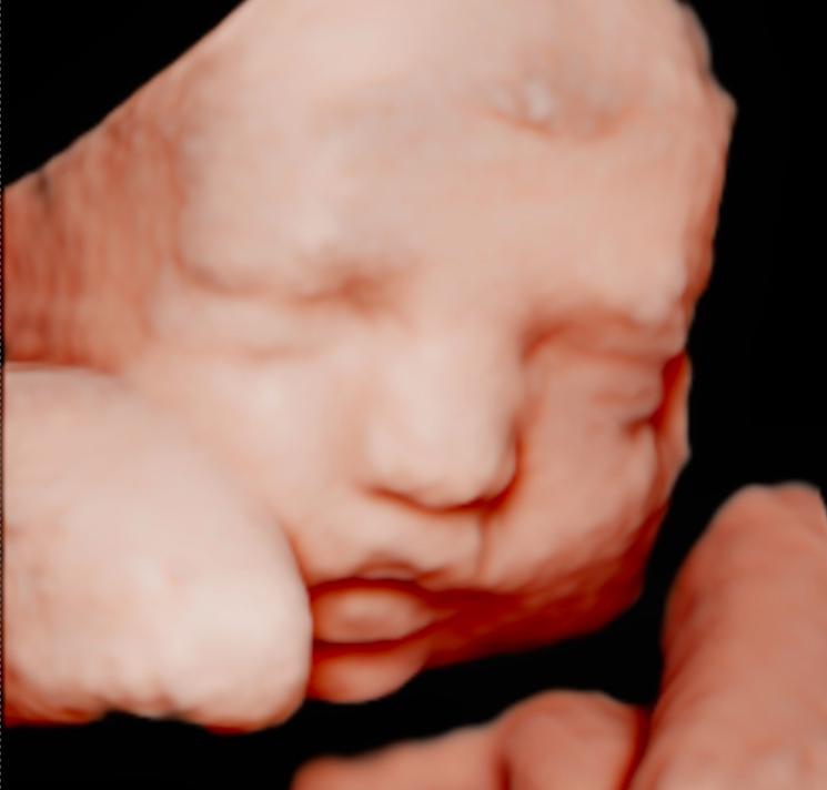 unnamed image