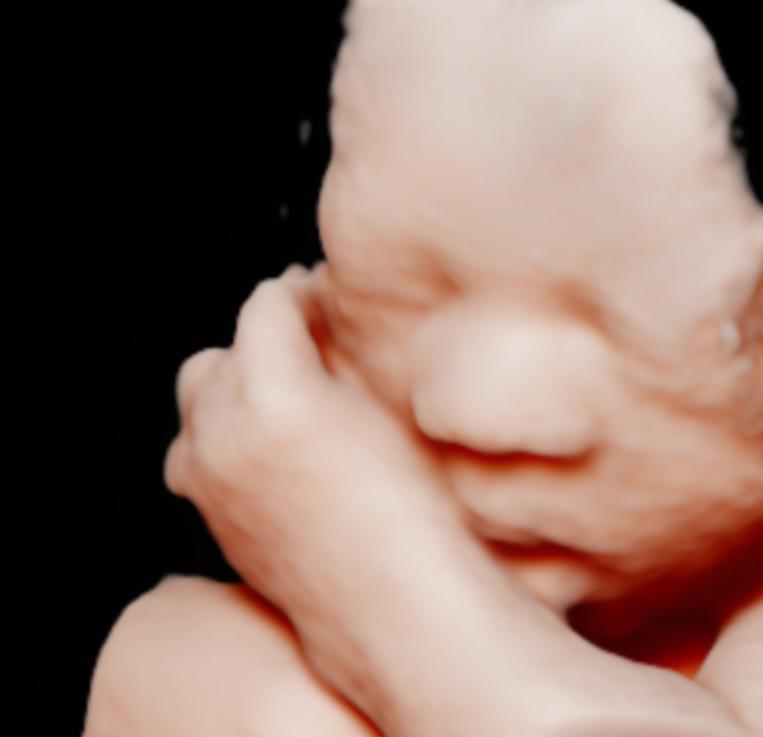 unnamed image