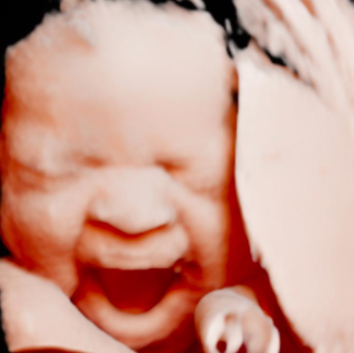 unnamed image