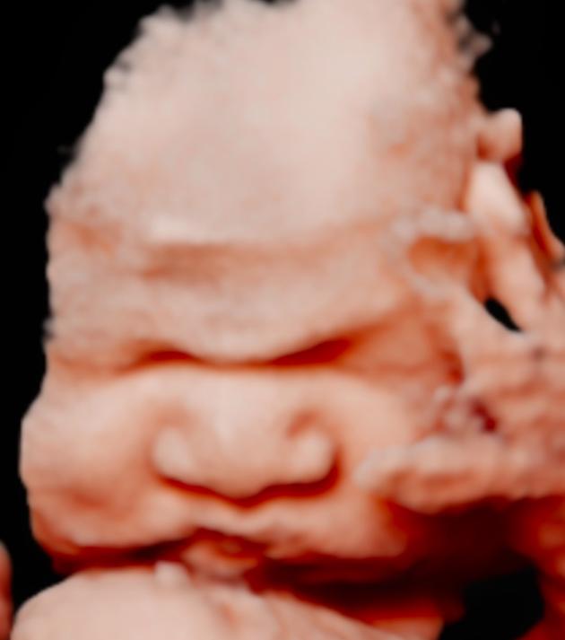 unnamed image