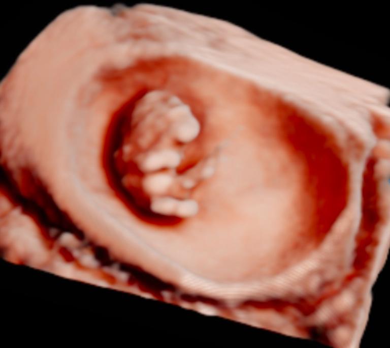 unnamed image