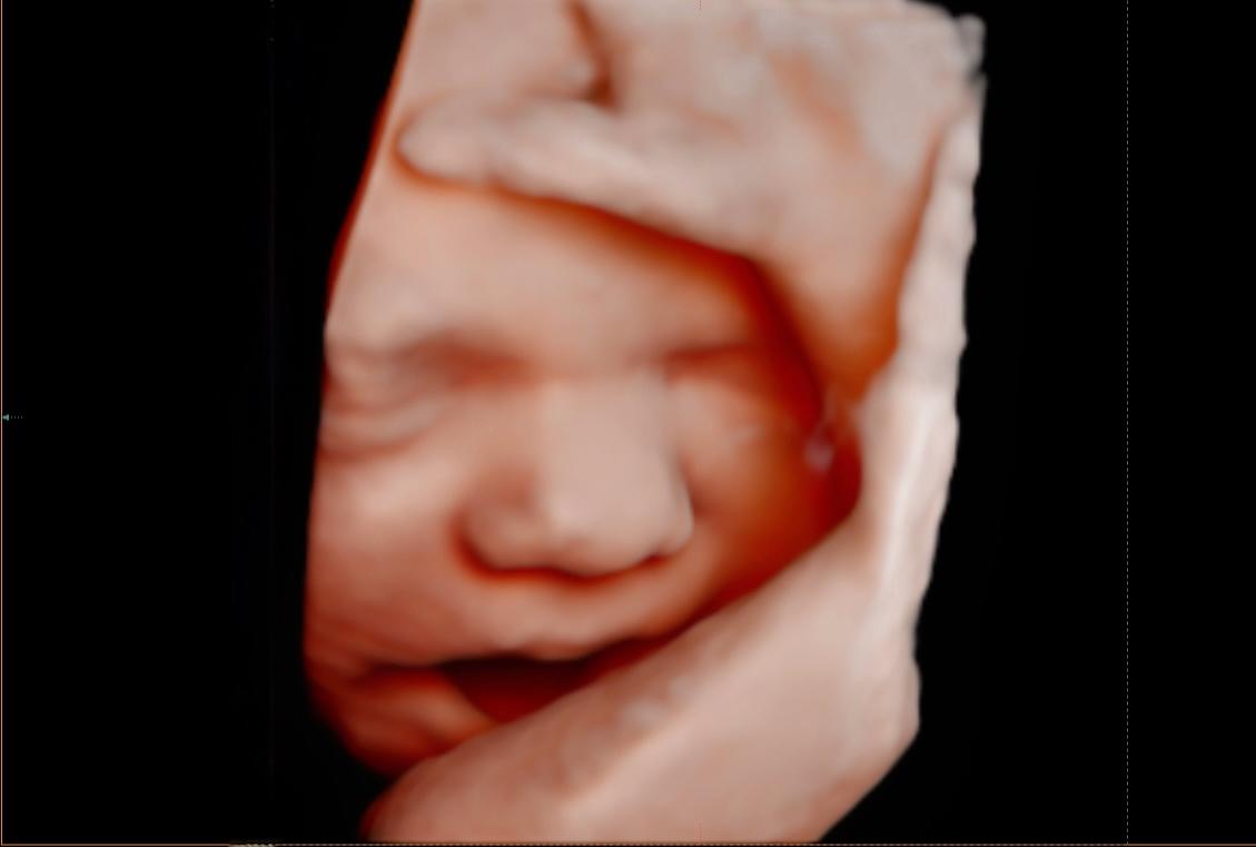 unnamed image