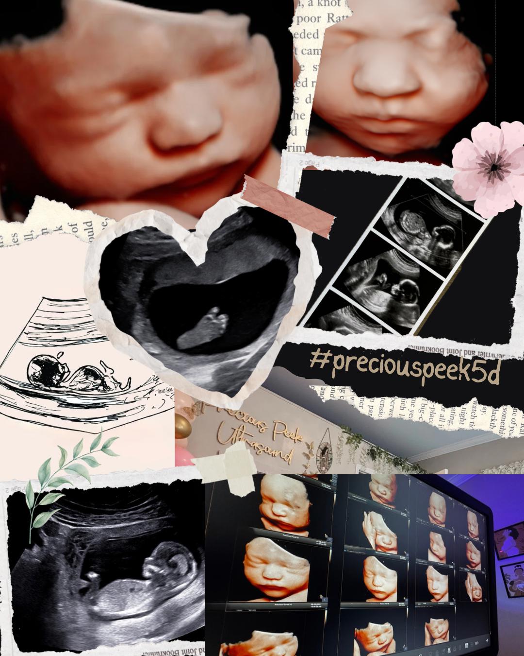 unnamed image