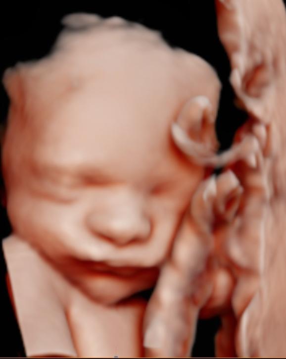 unnamed image