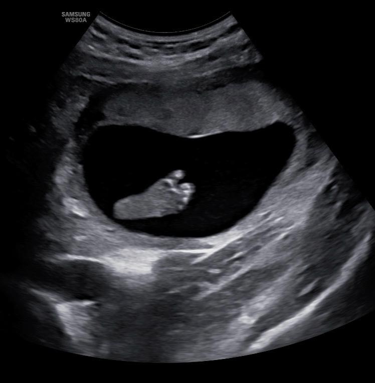 unnamed image