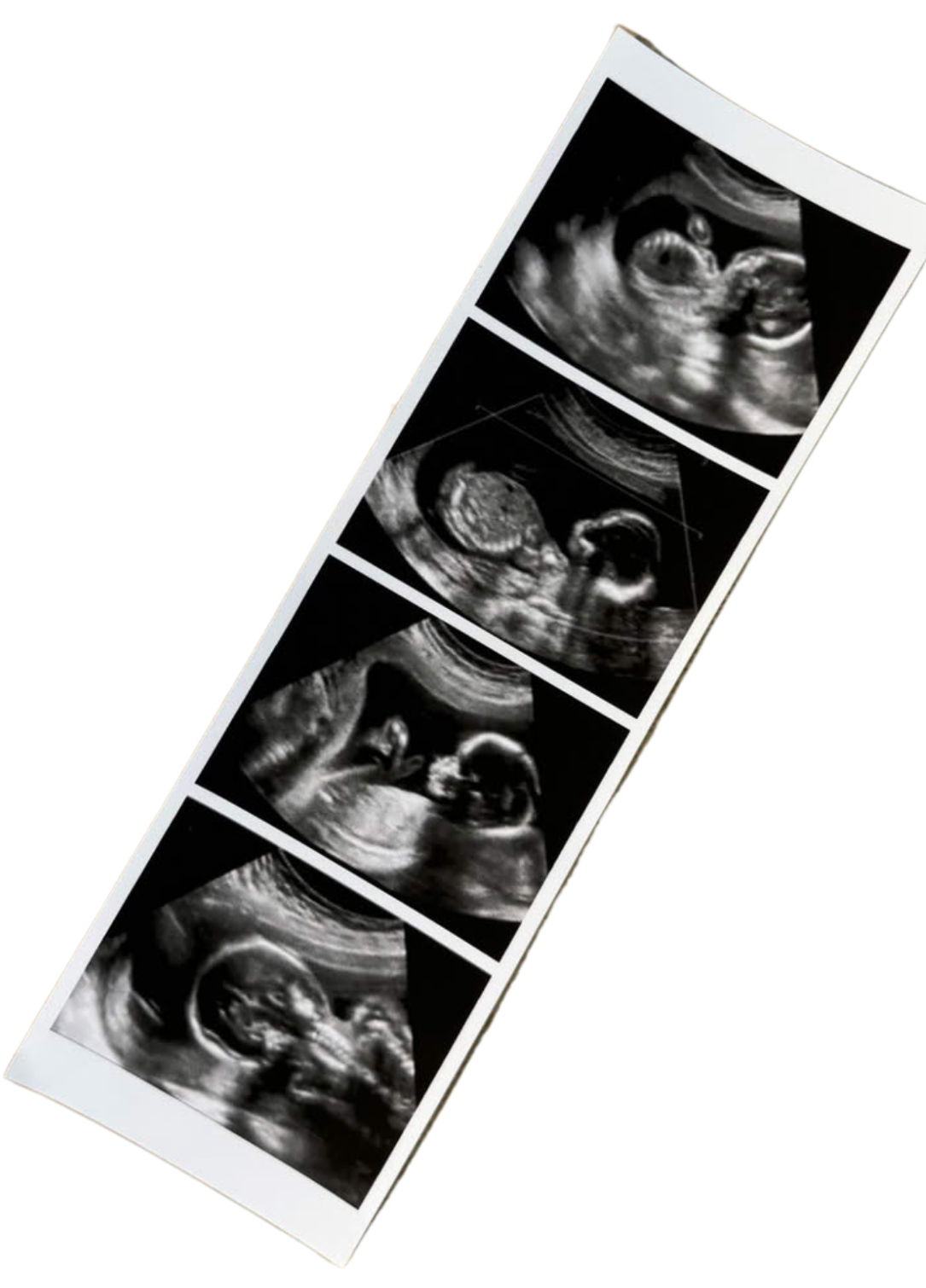 unnamed image