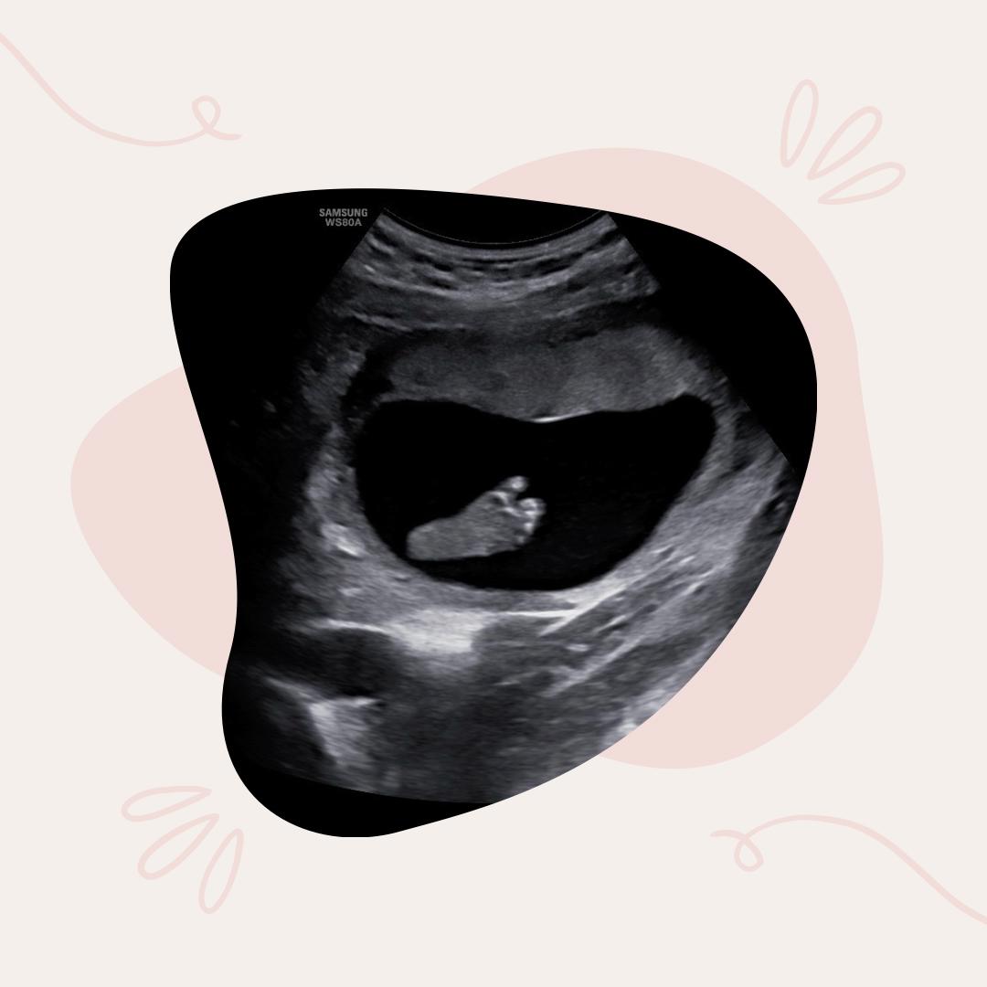 unnamed image